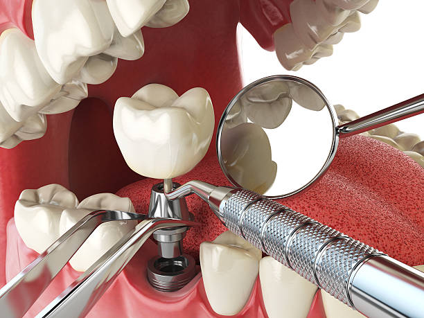 Best Weekend Emergency Dentist in Lexington, WA